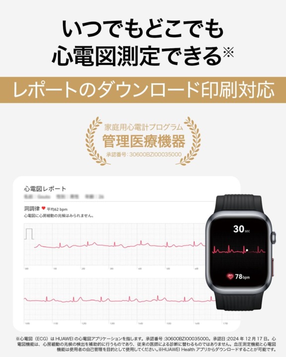 心電図機能付きスマートウォッチ 印刷