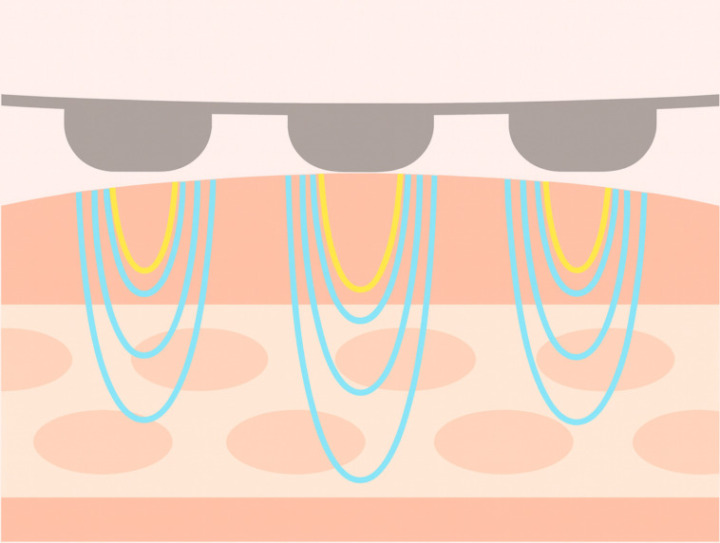 RF美顔器|高周波で肌深層から温めてハリをアップ