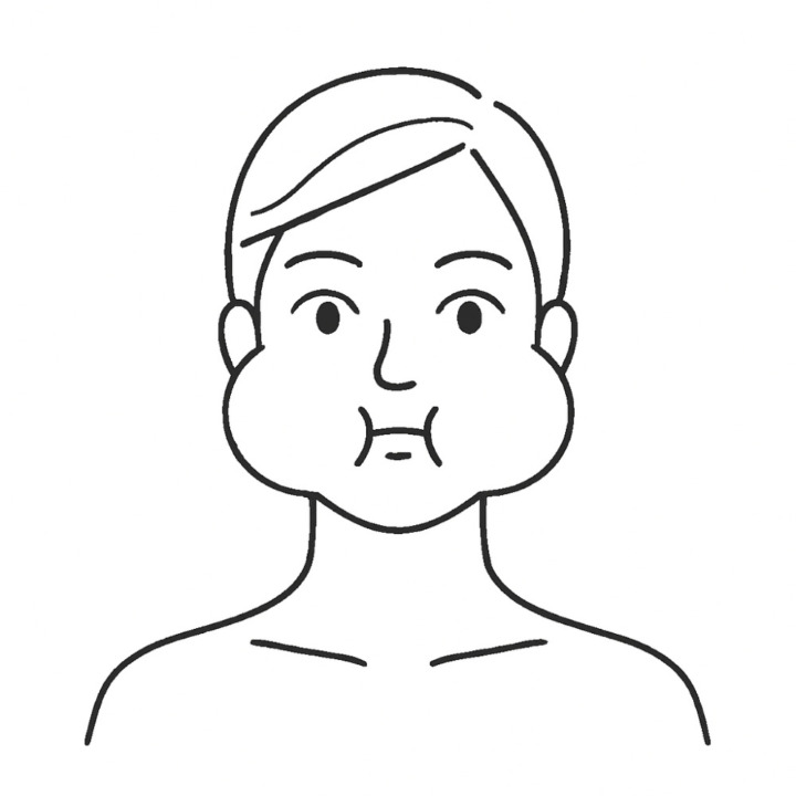 頬のトレーニング:大頬骨筋・小頬骨筋でリフトアップ